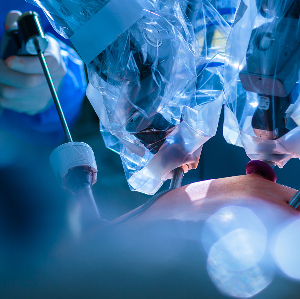 Robotic instruments being used during a surgical procedure.